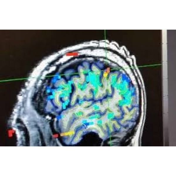 Clínica Depressão no Jardim Ângela - Como Se Livrar da Depressão