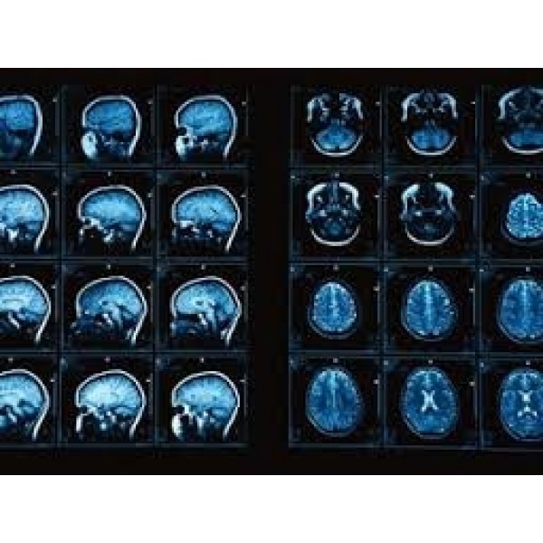 Clínica para Depressão Melhores Preços em Barueri - Como Sair da Depressão no Brooklin