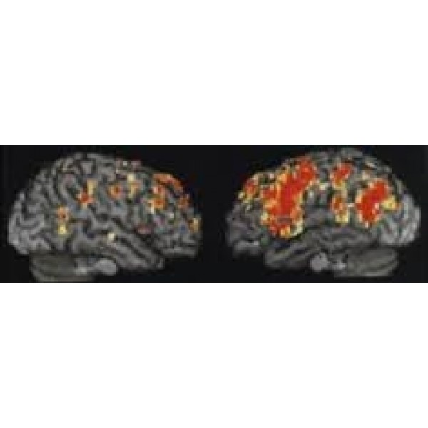 Clínica para Depressão Preços Acessíveis em Glicério - Como Curar Depressão