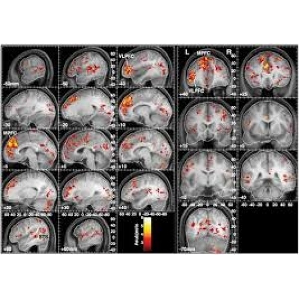 Clínica para Depressão Valor Acessível na Sé - Como Tratar Depressão Profunda