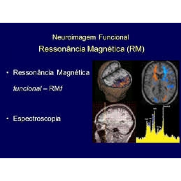 Clínica para Depressão Valor em Ermelino Matarazzo - Como Lidar com a Depressão