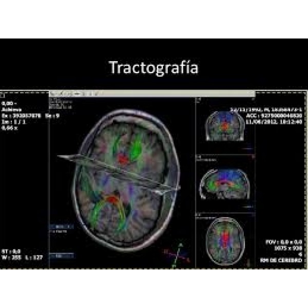 Clínica Psiquiátrica para Adultos Menor Valor no Aeroporto - Clínica Psiquiátrica