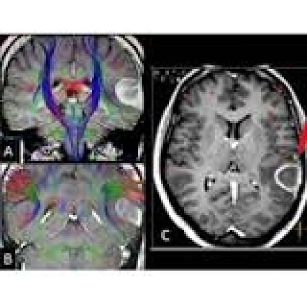 Clínica Psiquiátrica para Adultos Preço Acessível em Água Rasa - Clínica Psiquiátrica