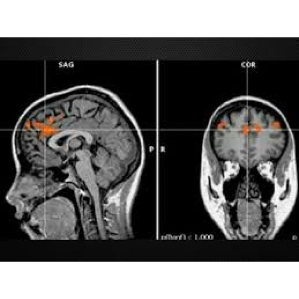 Clínica Psiquiátrica para Depressão Preços em Santa Cecília - Como Lidar com a Depressão