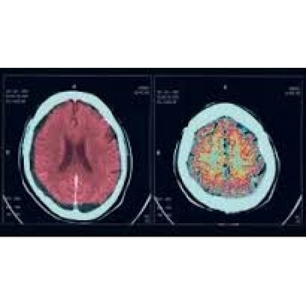 Clínicas para Depressão Melhor Valor em Itapevi - Como Sair da Depressão em Moema