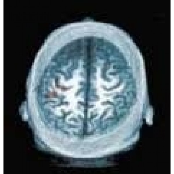 Clínicas para Depressão Menor Preço em Aricanduva - Como Sair da Depressão em Moema