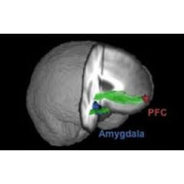 Clínicas para Depressão Menor Valor em Jandira - Como Lidar com a Depressão