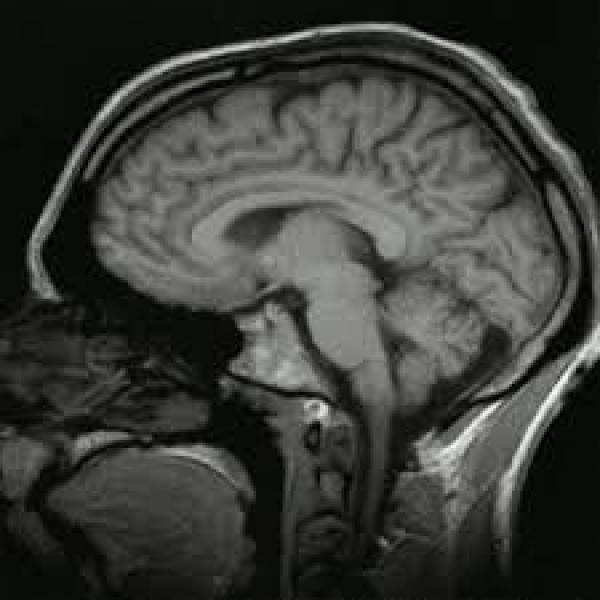 Clínicas para Depressão Menores Valores na Bela Vista - Como Evitar a Depressão