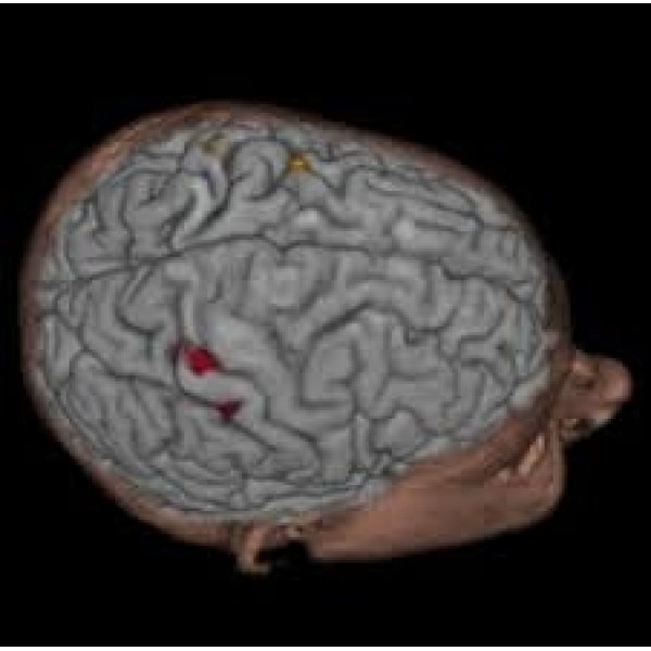 Clínicas para Depressão Onde Conseguir na Sé - Como Curar Depressão