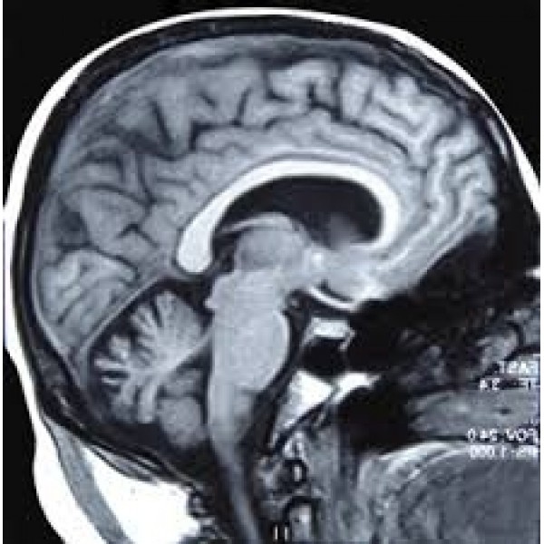 Clínicas para Depressão Preço Acessível em Sapopemba - Como Sair da Depressão no Brooklin