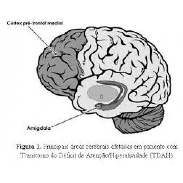 Clínicas Psiquiátricas para Depressão Preços Acessíveis em Artur Alvim - Como Sair da Depressão em São Paulo