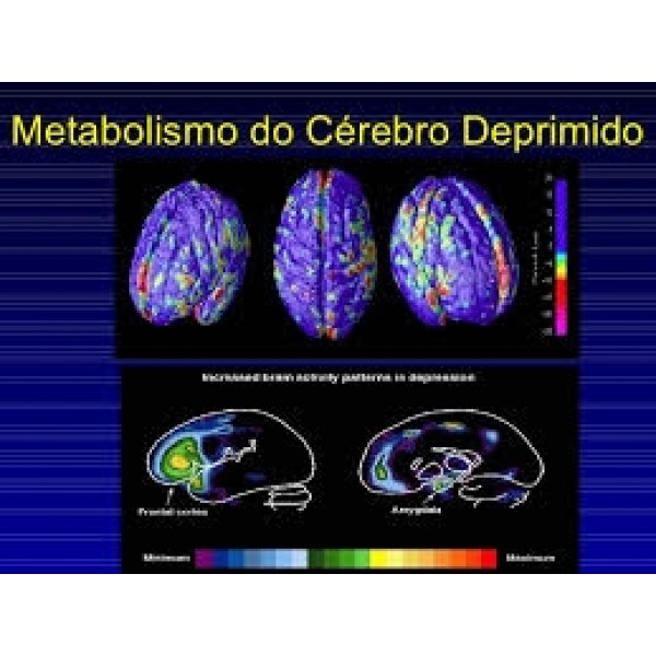 Clínicas Psiquiátricas para Depressão Valor no Jaraguá - Como Evitar a Depressão