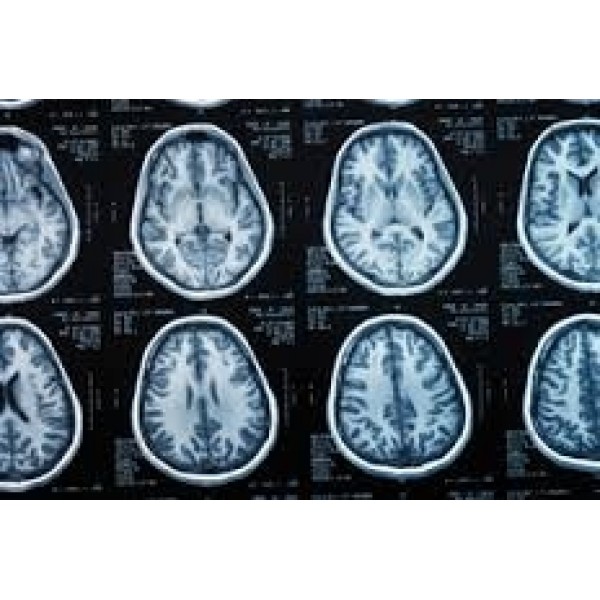 Como Curar a Depressão em Aricanduva - Como Lidar com a Depressão