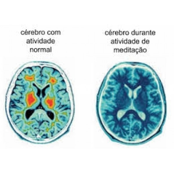 Como Fazer para Vencer a Depressão em São Lourenço da Serra - Como Lidar com a Depressão