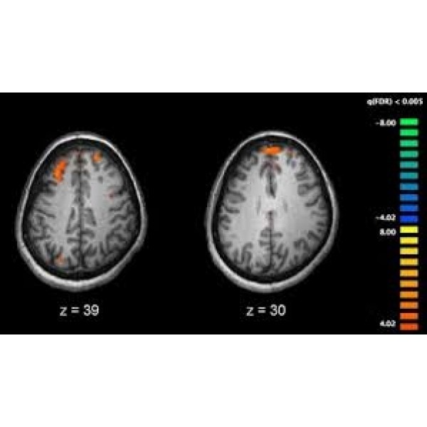 Como Tratar a Depressão em Cajamar - Como Sair da Depressão na Saúde