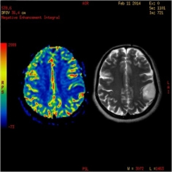 Cura para Depressão Valores na Barra Funda - Tratamento para Depressão em Moema