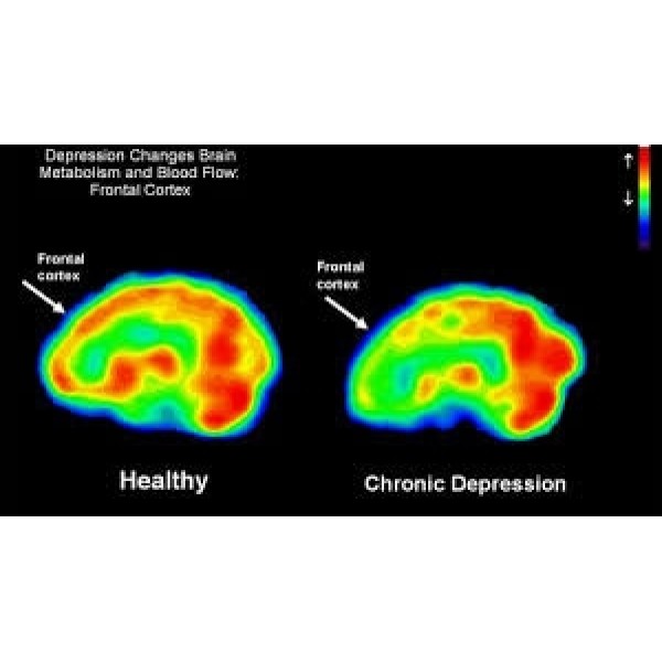 Psiquiatra Valores Baixos na Aclimação - Clínica Psiquiátrica para Depressão