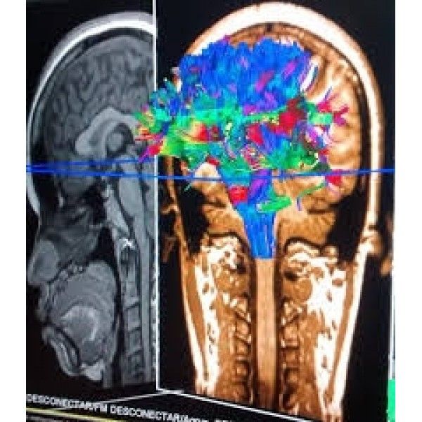 Psiquiatria para Internação Preços Acessíveis em Diadema - Clínica de Psiquiatria