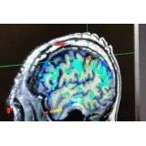 Clínicas para depressão em Interlagos