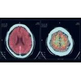 Clínicas para depressão melhor valor em Itapevi