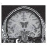 Clínicas para depressão valor acessível no Cambuci