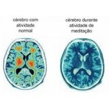 Como fazer para tratar depressão no Jabaquara