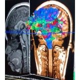 Psiquiatria para internação preços acessíveis em Diadema