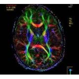 Psiquiatria para internação valor acessível no Arujá