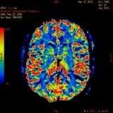 Tratamento para depressão com menores valores no Cambuci